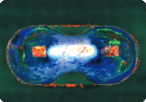 外観検査装置 対応ケース DIPブリッジ