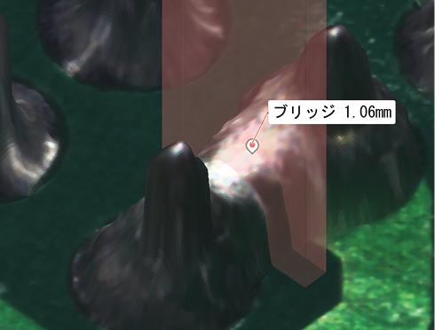 基板外観検査装置 検査項目 ブリッジ（3D）